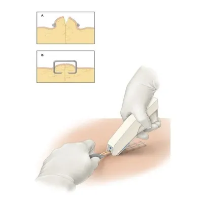 baytarlıq cərrahi zımbası